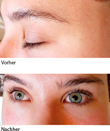 wimpern lifting